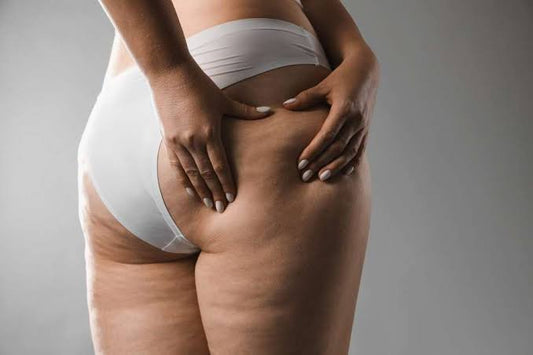 Retenção de Líquidos ou Gordura? Entenda as Diferenças e Como Cuidar da Sua Rotina